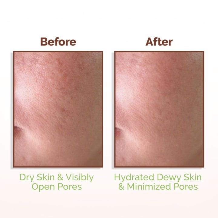 Mamaearth Rice Water Dewy Face Toner with Rice Water & 4% Niacinamide for Glass Skin | 150ml